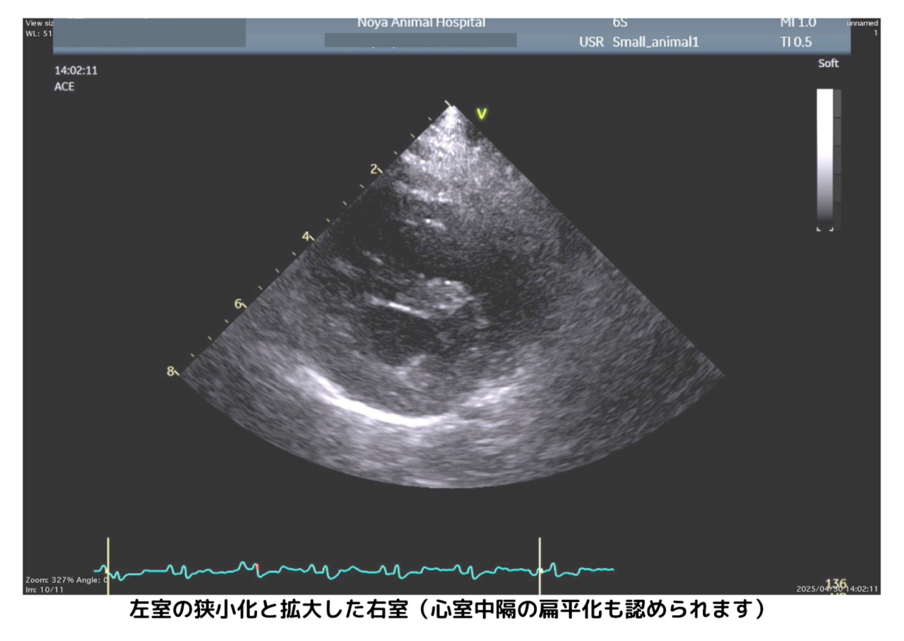 犬の心臓エコー検査画像。左心室の狭小化と右心室の拡大が確認され、心室中隔が扁平化している様子が映し出されている。